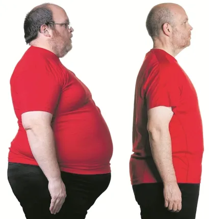 ବିନା ଖାଦ୍ୟରେ ୩୮୨ ଦିନ ବଞ୍ଚିପାରିଥିବା ମଣିଷ ହେଉଛନ୍ତି ଆଙ୍ଗସ୍‌ ବାର୍ବେରି