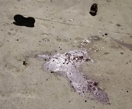 ସାଲିଆ ସାହିରେ ବୋମା ମାଡ଼, ଜଣେ ଗୁରୁତର