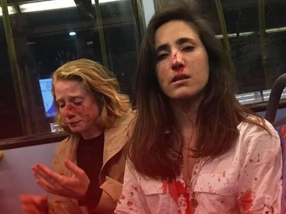 ଚଳନ୍ତା ବସ୍‌ରେ ଚୁମ୍ବନ ଦେବାକୁ ମନା କରିବାରୁ ଫ୍ଲାଇଟ୍‌ ଆଟେଣ୍ଡାଣ୍ଟ ଏବଂ ତାଙ୍କ ପ୍ରେମିକାଙ୍କୁ ମାଡ଼ ମାରିଲେ ଯୁବକ