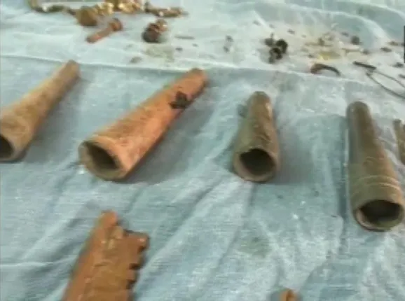 ଯୁବକଙ୍କ ପେଟ ଭିତରୁ ବାହାରିଲା ଗଞ୍ଜେଇ ଚିଲମ, ଡାକ୍ତର ହେଲେ ତାଜୁବ