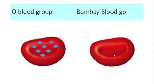 ‘ବମ୍ବେ ବ୍ଲଡ଼୍‍ ଟାଇପ୍‌’ ସଂପର୍କରେ ଏସବୁ ରୋଚକ କଥା ଜାଣନ୍ତି କି!