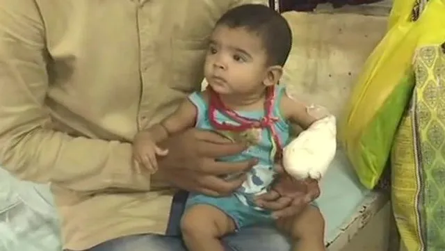 ଭୁଲରେ ନର୍ସ କାଟିଦେଲେ ପାଞ୍ଚମାସିଆ ଶିଶୁର ଆଙ୍ଗୁଳି !