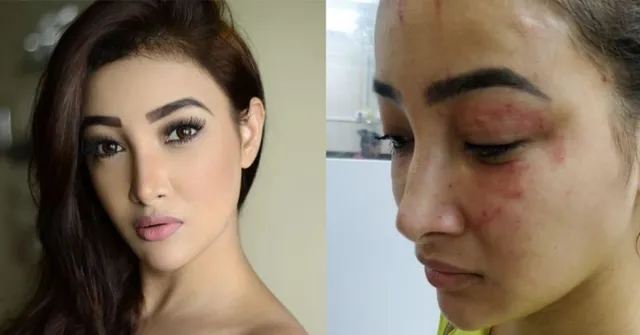 'ନାମକରଣ' ଅଭିନେତ୍ରୀଙ୍କୁ ମରଣାନ୍ତକ ଆକ୍ରମଣ : ଘର ଛାଡ଼ିବାକୁ କହିବାରୁ ମାଡ଼ ମାରିଲେ ବନ୍ଧୁ ଓ ତାଙ୍କ ମା’