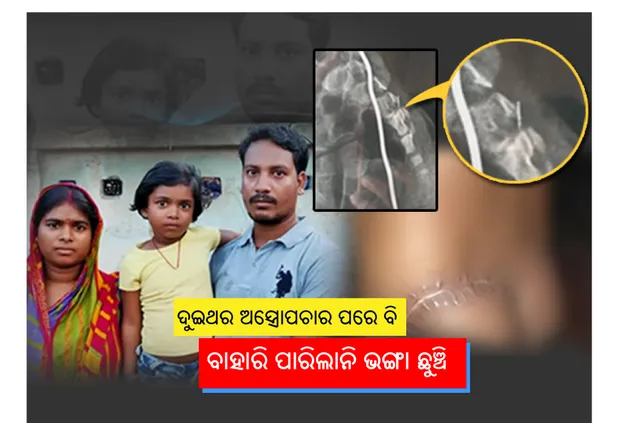 ଫାର୍ମସିଷ୍ଟଙ୍କ ଭୁଲ ହେତୁ ୨ ମାସ ହେବ ଶିଶୁ ଶରୀରରେ ରହିଥିବା ଭଙ୍ଗା ଛୁଞ୍ଚି ଅସ୍ତ୍ରୋପଚାର ପରେ ବି ବାହାରି ପାରୁନାହିଁ ! ଚିନ୍ତାରେ ପରିବାର