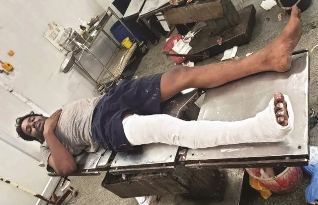 ଚୌଦ୍ୱାରରେ ଏନ୍‌କାଉଣ୍ଟର : କୁଖ୍ୟାତ ରାଜପଥ ଲୁଟେରା ଜିତୁ ଆହତ, ବନ୍ଧୁକ, ଗୁଳି, ବାଇକ୍‌ ଜବତ