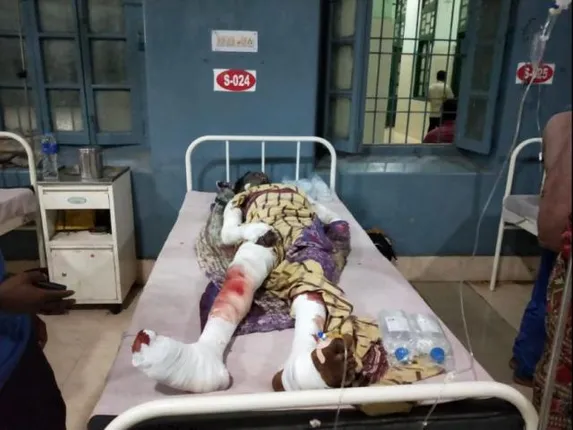 ବାରହା ମାରିବାକୁ ଘରେ ବୋମା ତିଆରି ବେଳେ ବିସ୍ଫୋରଣ: ଜଣେ ମୃତ, ୨ଗୁରୁତର