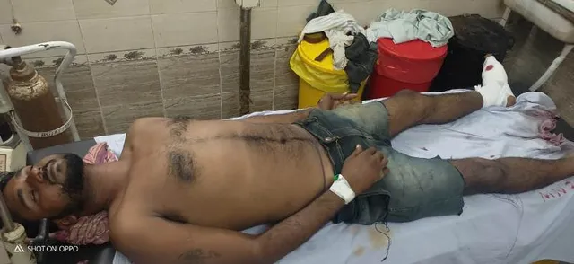 ସମ୍ବଲପୁରରେ ପୁଣି ଏନ୍‌କାଉଣ୍ଟର, କୁଖ୍ୟାତ ଅପରାଧୀ ଅମିତ ବିହାରୀ ଗିରଫ