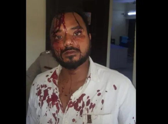 ବିଦ୍ୟୁତ ବିଲ କଲେକ୍‌ସନ୍‌ ଏଜେଣ୍ଟଙ୍କ ମାଡରେ ହୋଟେଲ ମାଲିକ ଆହତ