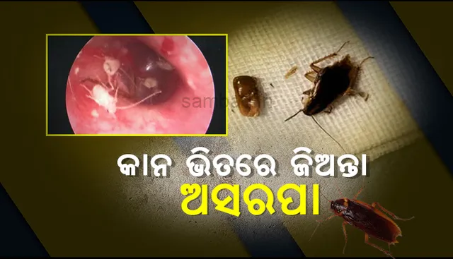 କାନରେ ହେଉଥିଲା ପ୍ରବଳ ଯନ୍ତ୍ରଣା, ଏକ୍ସ-ରେ ପରେ ଜଣାପଡ଼ିଲା ଭିତରେ ଅଛନ୍ତି ୧୦ଟି ଜିଅନ୍ତା ଅସରପା