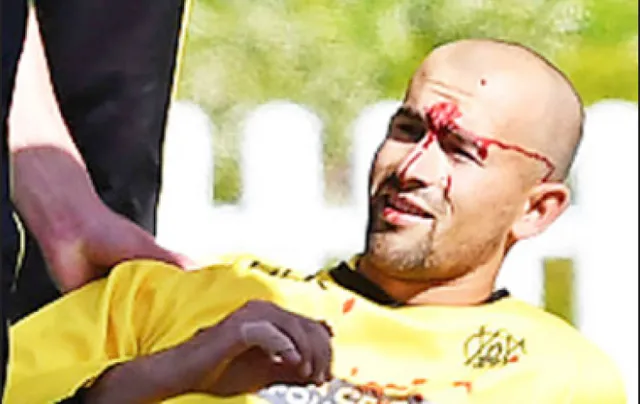 ଅଷ୍ଟ୍ରେଲିଆର ବାମହାତୀ ସ୍ପିନର ଅଷ୍ଟନଙ୍କ  ନାକ ଫାଟିଲା