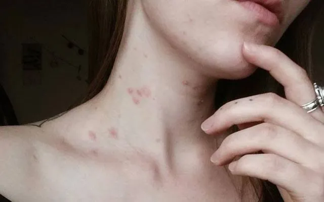 ରକ୍ତ କର୍କଟ ହେବାର ଦୁଇ ମାସ ପୂର୍ବରୁ ଶରୀର ଦେଇଥାଏ ଏଭଳି ୧୨ ସଂକେତ !