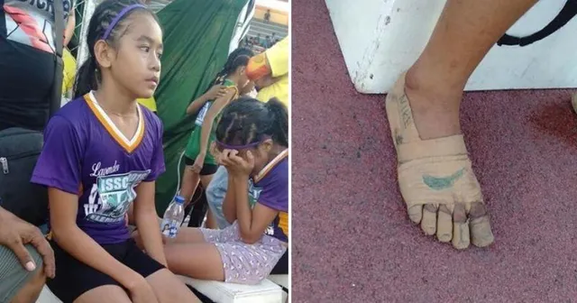 ଜୋତା ନଥିବାରୁ ପାଦରେ ବ୍ୟାଣ୍ଡେଜ ବାନ୍ଧି ଦୌଡ଼ିଲେ ଏହି କୁନି ଧାବିକା; ଜିତିଲେ ତିନିଟି ସ୍ୱର୍ଣ୍ଣ