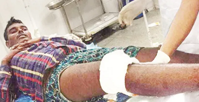 ନରାଜରେ ଏନ୍‌କାଉଣ୍ଟର : ଅସଲି ପୁଲିସ ଗୁଳିରେ ନକଲି ଜଖମ