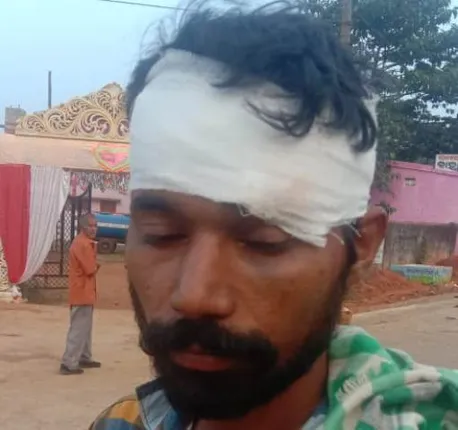 ଘୁ.ଉଦୟଗିରି: ଭାଇର ଟାଙ୍ଗିଆ ଚୋଟରେ ଭାଇ ଆହତ