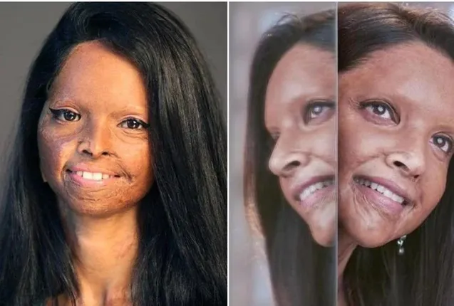 ଟ୍ରେଲର ରିଲିଜ୍ ହେବା ପରେ 'ଛପାକ୍' ଟିମ୍ ଓ ଏସିଡ୍ ପୀଡ଼ିତା ଲକ୍ଷ୍ମୀଙ୍କ ମଧ୍ୟରେ ଆରମ୍ଭ ହେଲା ବିବାଦ, ଜାଣନ୍ତୁ କାରଣ