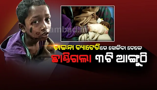 ଚାଇନା ବ୍ୟାଟେରିରେ ଖେଳୁଥିବା ବେଳେ ନାବାଳକଙ୍କର ପାପୁଲିରୁ ଛିଣ୍ଡିଗଲା ୩ଟି ଆଙ୍ଗୁଠି