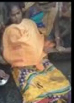 ହାତୀ ଆକ୍ରମଣରେ ମହିଳା ଗୁରୁତର, ଡାକ୍ତରଖାନାରେ ଭର୍ତ୍ତି