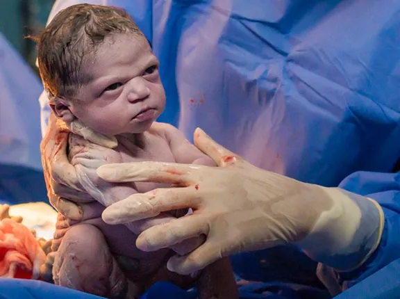 କନ୍ଦାଇବାକୁ ଚେଷ୍ଟା କରୁଥିବା ବେଳେ ଡାକ୍ତରଙ୍କୁ ରାଗରେ ଚାହିଁଲା ନବଜାତ !