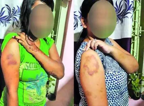 ଦୁଇ ଭଉଣୀଙ୍କୁ ନୂଆପଲ୍ଲୀ ପୁଲିସର ମାଡ଼ ଘଟଣା : ୫୦ହଜାର ଟଙ୍କା ଲେଖାଏଁ କ୍ଷତିପୂରଣ ଦେବାକୁ ମାନବାଧିକାର କମିସନଙ୍କ ନିର୍ଦେଶ