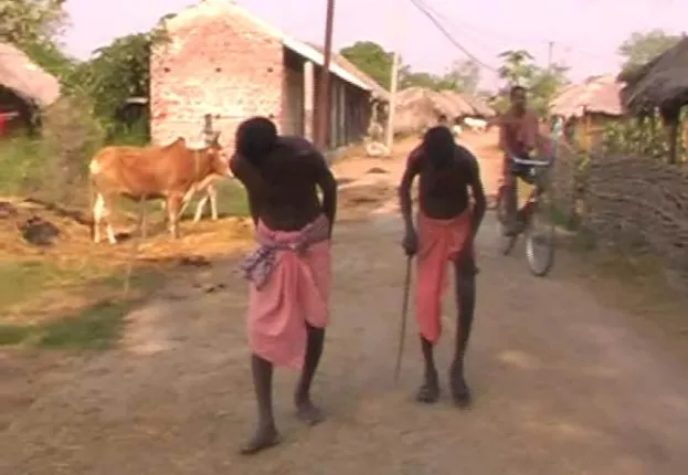 ଅଜଣା ରୋଗରେ ବଙ୍କେଇ ଯାଉଛି ପିଠିଅଣ୍ଟା : ୫ବର୍ଷରେ ଗଲାଣି ୧୦ ଜୀବନ, ୨୫ରୁ ଉର୍ଦ୍ଧ ଶଯ୍ୟାଶାୟୀ