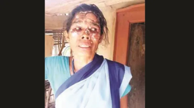 କରୋନା ସଚେତନତା ବେଳେ ଆକ୍ରମଣ : ଦଶପଲ୍ଲାରେ ଆଶାକର୍ମୀଙ୍କ ଉପରେ ଢାଳିଦେଲେ ତତଲା ପେଜ