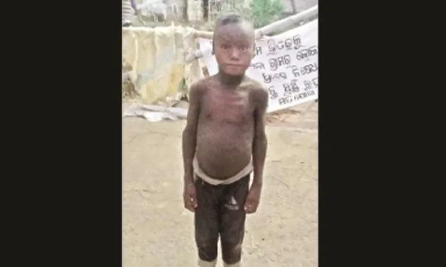 କରୋନା ଆଣିଲା ଦୁଃଖ : ଜଗାର ଚିକିତ୍ସା ଅଧାରୁ ବନ୍ଦ