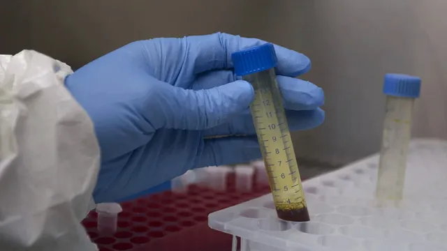 କରୋନା ଭାଇରସର ଆଣ୍ଟିବଡ଼ି ରାପିଡ଼ ଟେଷ୍ଟକୁ ସ୍ଥଗିତ ରଖିଲା ରାଜସ୍ଥାନ