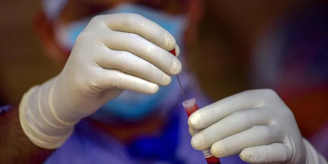 ଏପ୍ରିଲ ୨୩ରୁ ମାନବ ଉପରେ କୋଭିଡ-୧୯ ଟୀକା ପରୀକ୍ଷା ଆରମ୍ଭ କରିବ ଅକ୍ସଫୋର୍ଡ ବିଶ୍ବବିଦ୍ୟାଳୟ: ସ୍ୱାସ୍ଥ୍ୟ ସଚିବ