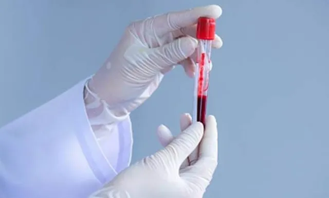 କରୋନା ଚିକିତ୍ସା ପାଇଁ ଭାରତର ପ୍ରଥମ ପ୍ଲାଜମା ଦାତା ହେବେ କେରଳ ଡାକ୍ତର !