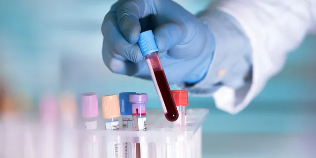 କରୋନା କାଳରେ ରକ୍ତ ପାଇଁ କଲବଲ ରୋଗୀ, ବିଏମ୍‌ସି ରକ୍ତଭଣ୍ଡାରର ୩ ଫ୍ରିଜର ଅଚଳ