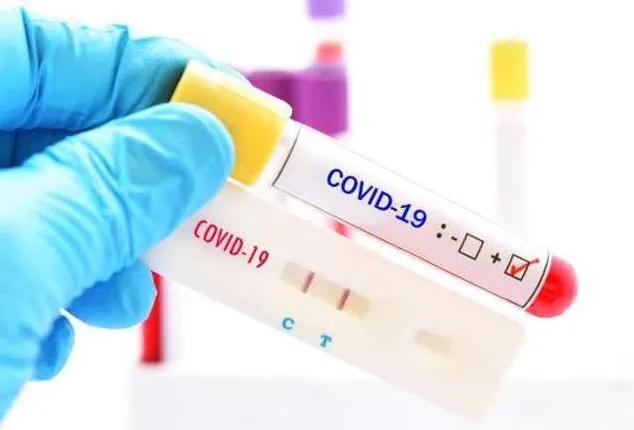 କଟକରେ ହେବ ରାପିଡ୍‌ ଆଣ୍ଟିଜେନ୍‌ ଟେଷ୍ଟ, ଅଧଘଣ୍ଟାରେ ଜଣାପଡ଼ିବ କୋଭିଡ୍‌ ଷ୍ଟାଟସ୍‌