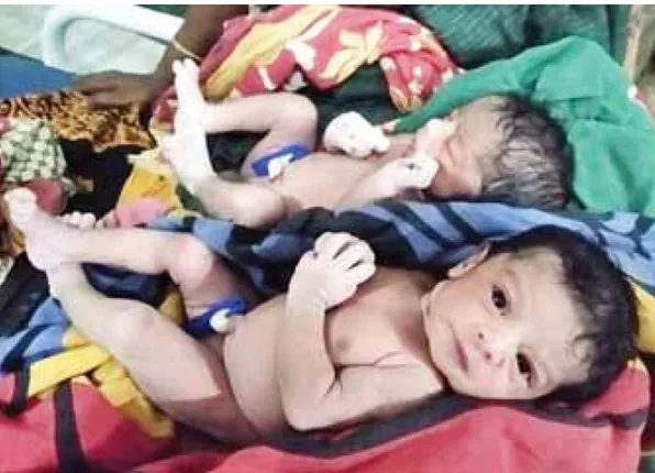 ଅମ୍ଫାନରେ ଜନ୍ମନେଲେ ୬୦ ଶିଶୁ, ସବୁ ନବଜାତ ସୁରକ୍ଷିତ