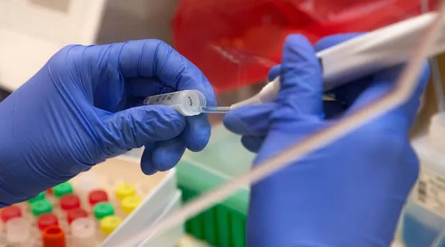 କପିଳେଶ୍ୱରରୁ କରୋନା ଆକ୍ରାନ୍ତ ବାହାରିବା ଘଟଣା : ବିଏମ୍‌ସି ରିପୋର୍ଟ ପଜିଟିଭ୍‌, ଘରୋଇ ହସ୍ପିଟାଲରେ ନେଗେଟିଭ୍‌