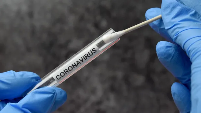 ଆଇଗିଣିଆ ଆଳୁ ଗଦିରୁ ବାହାରିଲେ ୯ ଆକ୍ରାନ୍ତ