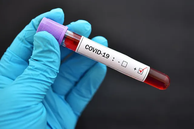 ବାଲିଅନ୍ତାରେ ଡାକ୍ତରଙ୍କ ସହ ୭ ପଜିଟିଭ୍‌