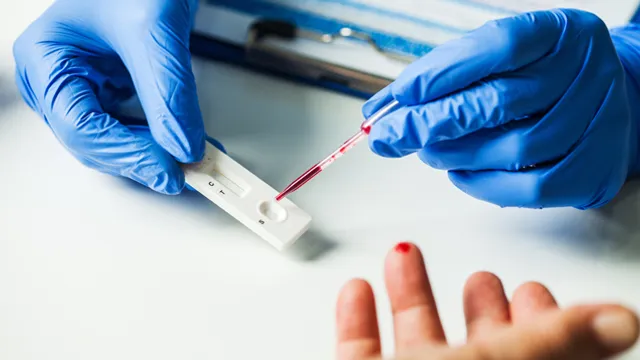 ୪୫୦ ଟଙ୍କାରେ ଆଣ୍ଟିଜେନ ପରୀକ୍ଷା ବିବାଦ : କଟକରେ ଘରୋଇ କୋଭିଡ୍‌ ପରୀକ୍ଷା ବନ୍ଦ