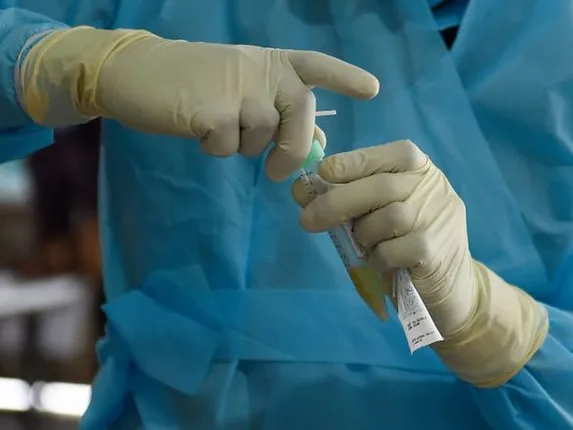 ରାଜ୍ୟରେ କୋଭିଡ୍‌ ନମୁନା ପରୀକ୍ଷା ଟପିଲା ୫ ଲକ୍ଷ