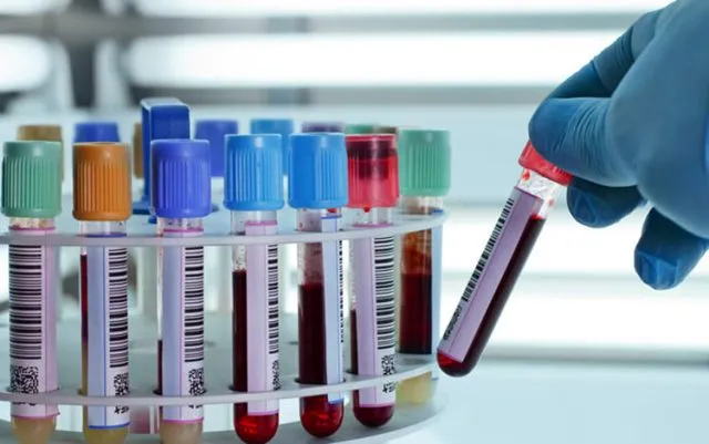 କୋରାପୁଟ ଜିଲ୍ଲାରୁ ୩୩ କରୋନା ଆକ୍ରାନ୍ତ ଚିହ୍ନଟ, ସଂକ୍ରମିତଙ୍କ ସଂଖ୍ୟା ୪ ଶହ ଟପିଲା