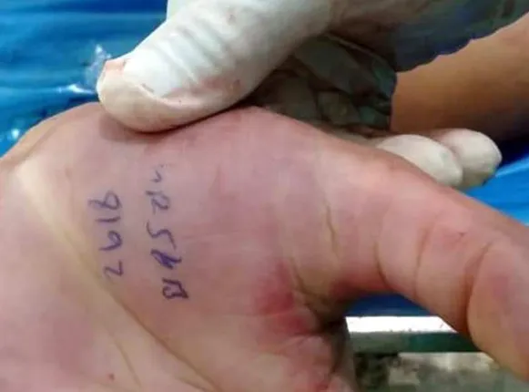 ମୃତ୍ୟୁ ପୂର୍ବରୁ କନେଷ୍ଟବଳ ହାତରେ ଲେଖିଦେଲେ ଅପରାଧୀଙ୍କ ଗାଡି ନମ୍ବର, ଖୋଜି ଧରିଲା ପୁଲିସ