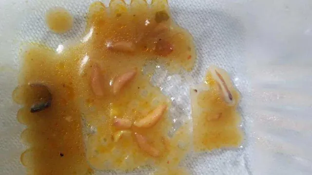 ଖାଦ୍ୟରୁ ବାହାରୁଚି ପୋକ, କାମ କରୁନି ପଙ୍ଖା; ଦୁଃଖ ବଖାଣିଲେ କୋଭିଡ-୧୯ ଡିଉଟିରେ ଥିବା ଲକ୍ଷ୍ନୗ ଡାକ୍ତରଖାନାର ଡାକ୍ତର