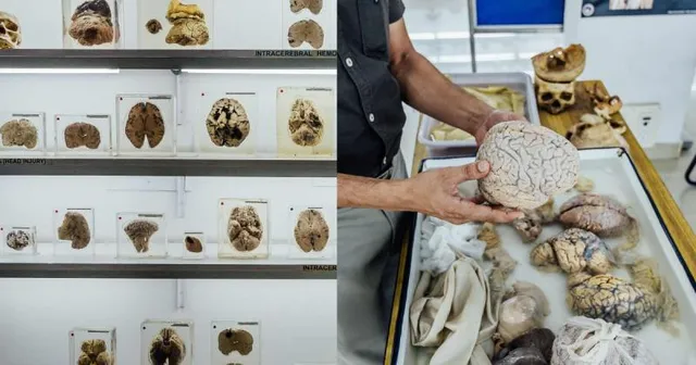 ନୂଆ ସମୟ ନୂଆ କଥା : ମସ୍ତିଷ୍କ ସଂଗ୍ରହାଳୟ ଏବଂ ୬.୫ ଫୁଟ୍‌ ଲମ୍ବା ଡାଇନୋସର୍‌ ଜଙ୍ଘ ହାଡ଼