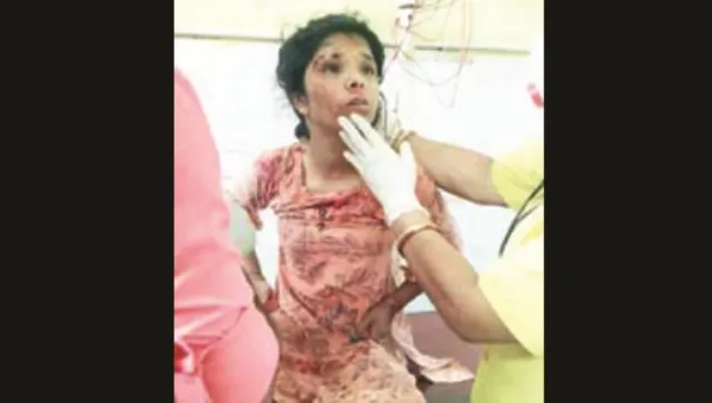 ଦୁର୍ଘଟଣାରେ ଆହତ ଯୁବତୀଙ୍କୁ ନିଜ ଗାଡ଼ିରେ ଡାକ୍ତରଖାନାକୁ ନେଲେ ପାଣ୍ଡିଆନ