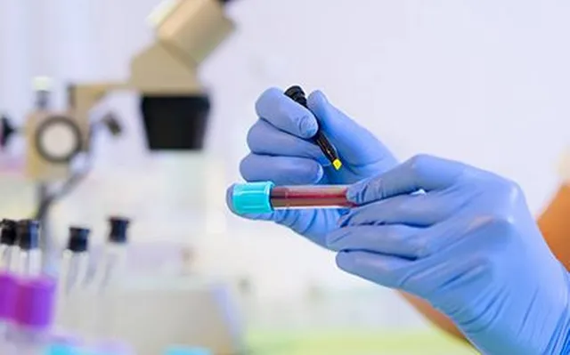 ମାଲକାନଗିରି କୋଭିଡ ଚିକିତ୍ସାଳୟରେ ୩ ଜଣ କରୋନା ଆକ୍ରାନ୍ତଙ୍କୁ ପ୍ଲାଜ୍‌ମା ଥେରାପି ପ୍ରଦାନ