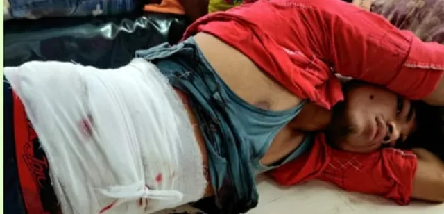 ଗୁପ୍‌ଚୁପ୍ ବିକାଳିଙ୍କୁ ଗୁଳି: ଅଭିଯୁକ୍ତ ଗିରଫ, ବିହାରରୁ ଆଣିଥିଲା ପିସ୍ତଲ, ଗୁରୁତର କଟକ ସ୍ଥାନାନ୍ତର