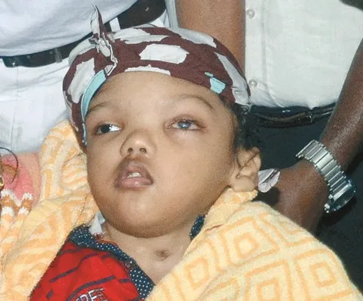 ଜଗାକୁ ଛାଡ଼ି ଚାଲିଗଲା ବହୁଚର୍ଚ୍ଚିତ କନ୍ଧମା‌ଳର ଯୋଡ଼ାମୁଣ୍ଡ ଶିଶୁ ବଳିଆ