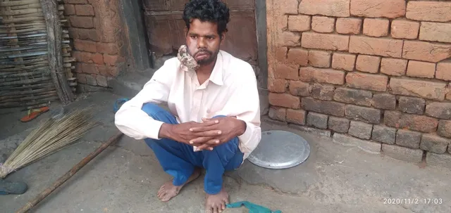 ମୁଖ କର୍କଟ ରୋଗ ଯନ୍ତ୍ରଣାରେ ଛଟପଟ ପୁଇଁନ ମାଝୀ; ସରକାରୀ ସାହାଯ୍ୟ ଅପେକ୍ଷାରେ ପୀଡିତ