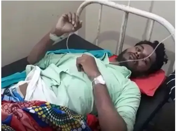 ଆଶ୍ଚର୍ଯ୍ୟ! ଯନ୍ତ୍ରଣାରେ ଛଟପଟ ହେଉଥିବା ରୋଗୀଙ୍କ ବାମ କିଡନିରୁ ପଥର ବାହାର କରିବା ବଦଳରେ ଡାକ୍ତର ଡାହାଣ କିଡନି ବାହାର କରି ଦେଲେ