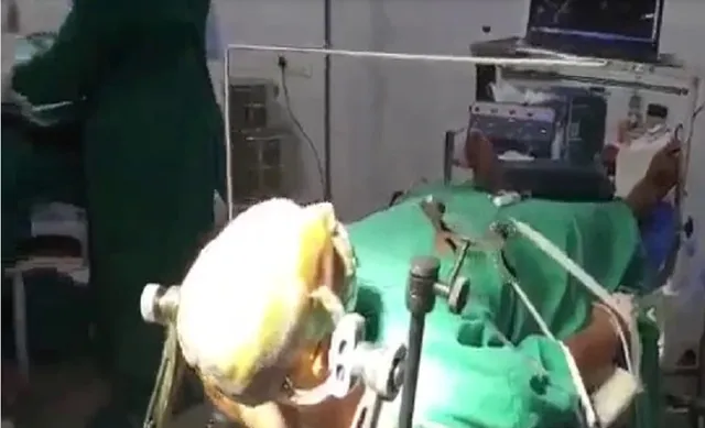 ଅପରେସନ୍ ଥିଏଟରରେ 'ବିଗବସ' ଦେଖୁଥିଲେ ରୋଗୀ, ମସ୍ତିଷ୍କ ଅପରେସନ କଲେ ଡାକ୍ତର