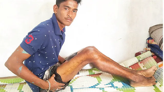 ଅର୍ଥାଭାବରୁ ହୋଇ ପାରୁନି ଅପରେସନ୍‌, ଦୁର୍ଘଟଣା ଛଡ଼ାଇନେଲା ପାଠପଢ଼ା