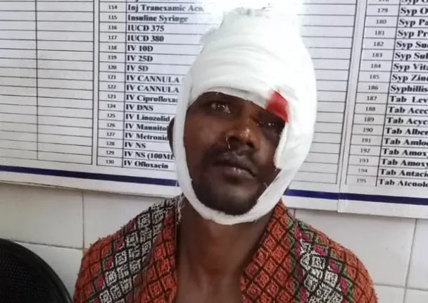 କାଲିମେଳା :  ସଡ଼କ ଦୁର୍ଘଟଣାରେ ଜଣେ ଆହତ